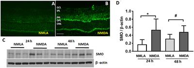 Targeting Polyamine Oxidase to Prevent Excitotoxicity-Induced Retinal Neurodegeneration